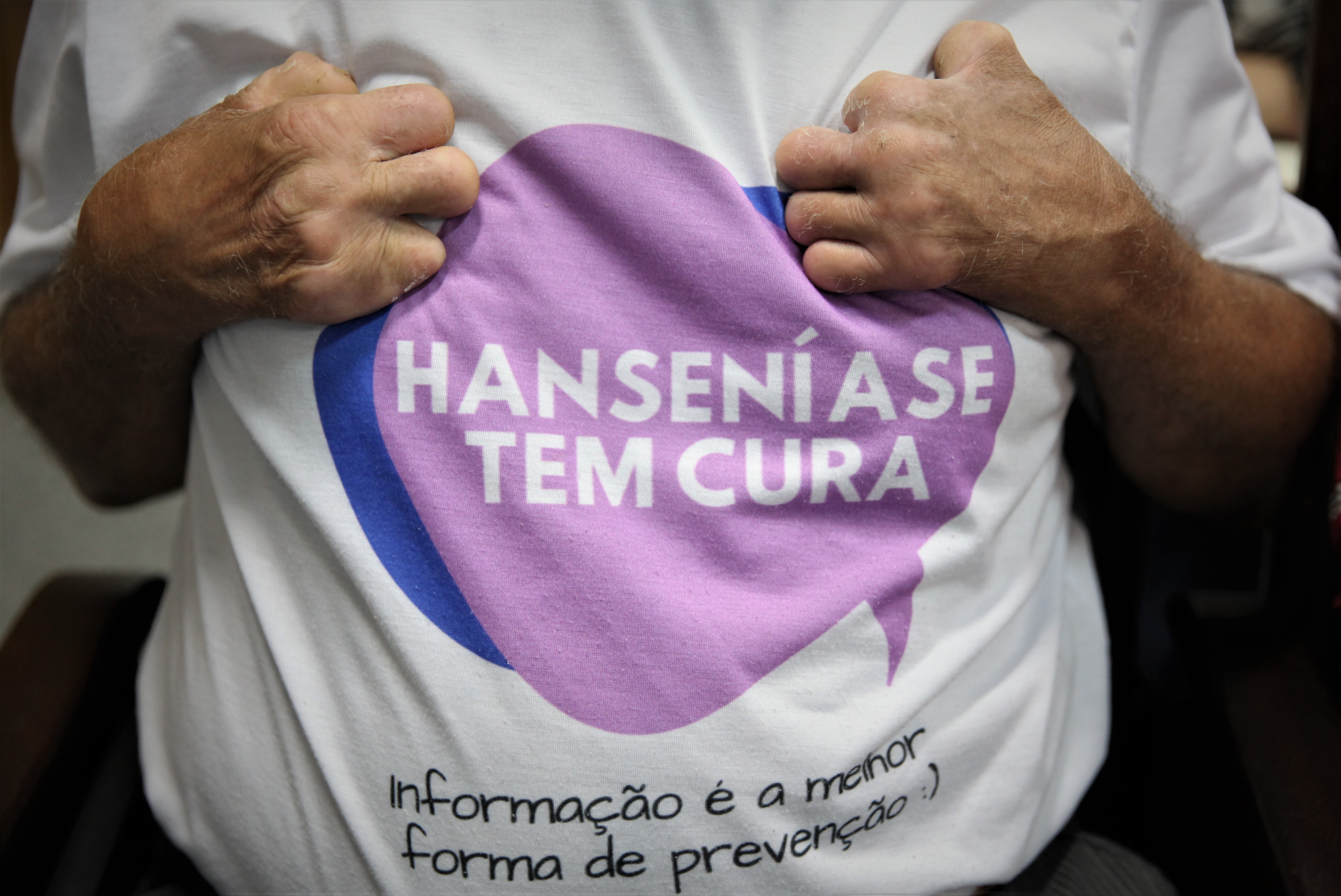 Saúde do Acre apoia campanha Janeiro Roxo, de prevenção à hanseníase