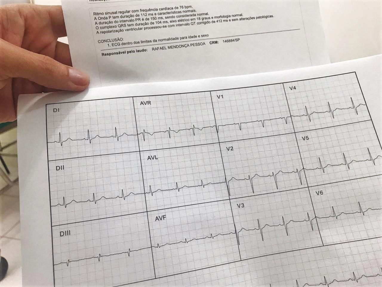 Policlínica do Tucumã passa a oferecer eletrocardiograma digital