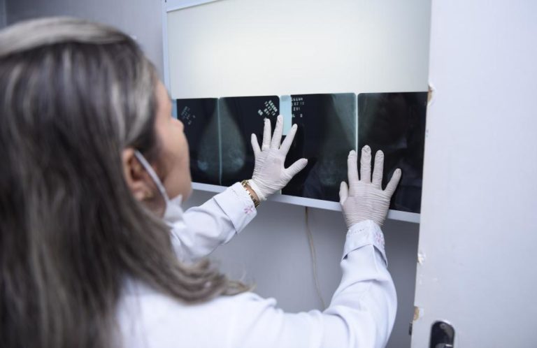 Nova lei garante preparação e reabilitação fisioterapêutica para mulheres mastectomizadas no Acre